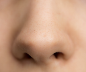 Set de nariz para Rinoplastia